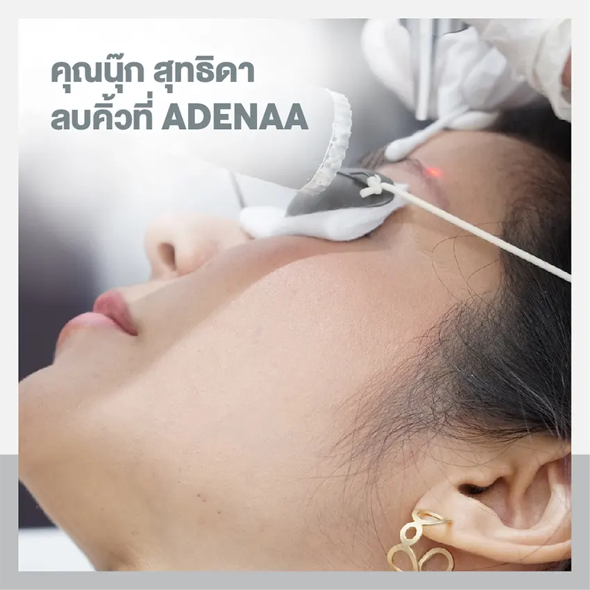 Khun Nook Suthida has her eyebrows removed at Adenaa.